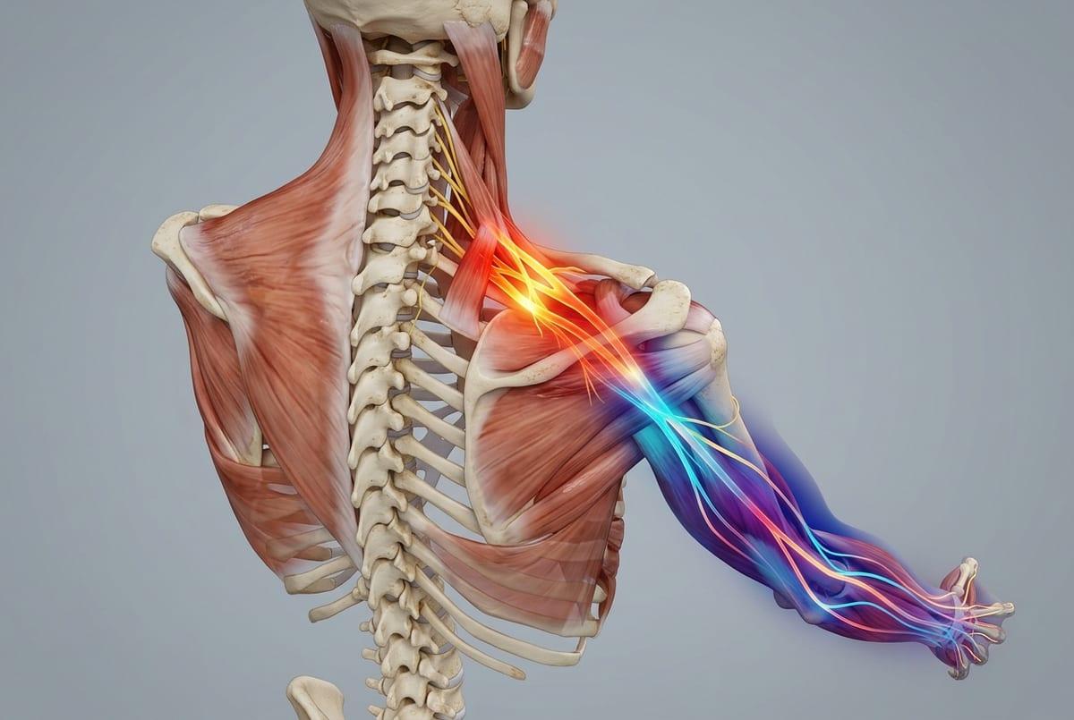 Nerve irritation and the ‘electric’ traveling sensation